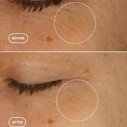 Mayteo Retinol Alternative Eye Serum, sfeerbeeld