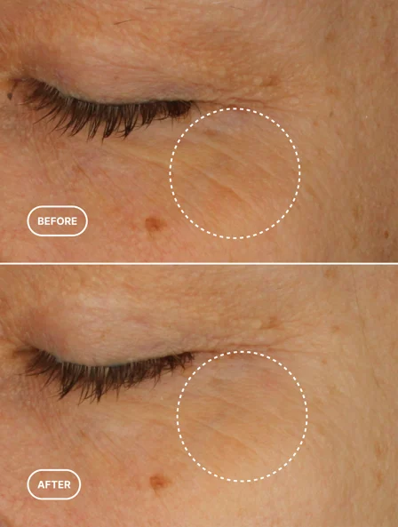 Retinol Alternative Eye Serum 15ml