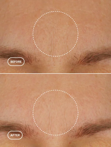 Retinol Alternative Moisturiser 50ml